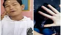 Modus Agus pria disabilitas tanpa tangan lakukan pemerkosaan terhadap seorang mahasiswi di NTB