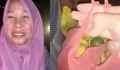 Air Mata Relawan di Geudumbak Aceh Utara Pecah, Diberi Jeruk Nipis Saat Pemulihan Pascabanjir