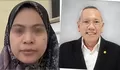 Tjandra Yoga Aditama Soroti Empati Nakes Usai Komentar terhadap Pasien BPJS di RSUD dr. Soekardjo Tasikmalaya Viral