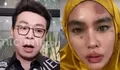 Richard Lee Tanggapi Muka Kartika Putri Alami Ruam sampai Melepuh: Mudah-mudahan Buka Azab