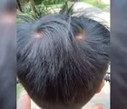 Unyeng Uyeng Pada Rambut Anak Bertanda Apakah?
