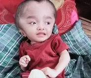 Tangis Maria Bocah 3Tahun di Manggarai Timur: Butuh Pertolongan, Kepala Terus Membesar, Orangtua Habis Harta Demi Pengobatan