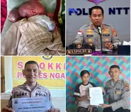 Tersentuh Kisah Prisilia, Kapolda NTT Irjen Pol Rudi Darmoko Kirim Bantuan: "Segera Bawa Bayi Ini ke Kupang"