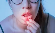 Wajib Tahu! Ini Perbedaan Gejala Sariawan dengan Kanker Mulut