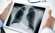 Dharmasraya Dapat 2 X-Ray Portable dari Kemenkes, Deteksi TBC Kini Bisa Lebih Dekat