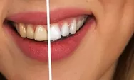 Viral! Ayo Cek Seberapa Kuning Gigimu dengan Filter IG Story, Fitur Instagram bisa Cek Tingkat Keputihan Gigi