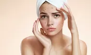 Tips Memerangi Jerawat Hormonal, Masalah Kecantikan Bagi Wanita
