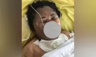 Seorang Wanita di Deli Serdang Sekarat Dibakar Hidup-hidup, Pelaku Sakit Hati Gegara Hal ini