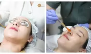 Pendekatan Menyeluruh Miracle Aesthetic Clinic, Tangani Hiperpigmentasi Kulit Pelanggan Indonesia