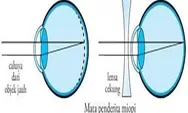 Cara Mencegah dan Mengobati Rabun Jauh Bertambah Parah