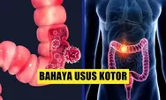 Lakukan Ini Jangan Sampai Usus Kotor, dan Hindari ini Jika Tidak Ingin Melakukan Kolonoskopi