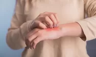 Apakah Alergi Bisa Disembuhkan? Simak Penjelasannya