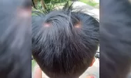 Unyeng Uyeng Pada Rambut Anak Bertanda Apakah?