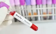 Alert! Pria 59 Tahun Meninggal Dunia Akibat Flu Burung H5N2, Ini Penjelasan WHO