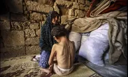 Krisis Kemanusiaan di Gaza Terus Memburuk, Total Warga Meninggal Akibat Kelaparan dan Malnutrisi 251 Orang, Termasuk 110 Anak