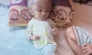 Pilu Maria, Bocah 3 Tahun Asal Manggarai Timur: Kepalanya Terus Membesar, Orangtua Hampir Menyerah