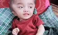 Tangis Maria Bocah 3Tahun di Manggarai Timur: Butuh Pertolongan, Kepala Terus Membesar, Orangtua Habis Harta Demi Pengobatan