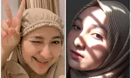Potret Cantik dan Necis Auzura Qrzura Selebgram Viral, Pipi Tembemnya Bikin Suami Orang Acuh ke Istri Sendiri
