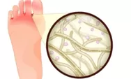 Wajib Tahu! Apakah Air Garam Bisa Menyembuhkan Kutu Air pada Kaki? Inilah Penjelasannya 