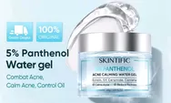 5 Rekomendasi Moisturizer untuk Acne Prone: Mulai dari Brand Lokal hingga Internasional
