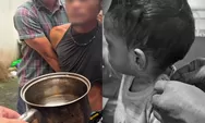 Miris! Balita 2 Tahun di Padang Diduga Dianiaya Ayah Kandung