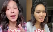 Bunda Corla pamer video sebelum dan sesudah operasi plastik facelift, netizen beri respon cantik yang dulu