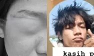 Curahan hati JC usai viral ditendang pacar di Bandung, beberkan kronologi dan langkah hukum