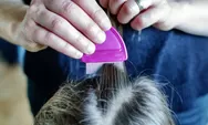 Cara Mengusir Kutu Rambut dengan Ramuan Dapur, Dijamin Minggat Selamanya, Begini Langkahnya