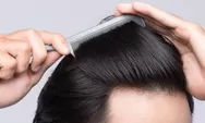 5 Efek Samping Penggunaan Pomade yang Perlu Kamu Tahu