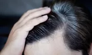 Jangan Panik! Ini 6 Solusi Efektif Menghilangkan Uban di Rambut Muda Anda