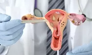 129 Perempuan di Sumbar Positif HPV DNA pada 2025, DWP Perkuat Pencegahan Kanker Serviks