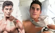 MotoGP 2025: Dokter MotoGP Ungkap Cedera Serius Marc Marquez