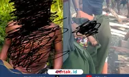 Anak Korban Operasi Militer Kemburu Meninggal Setelah 36 Hari Dirawat