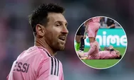 Pelatih Argentina Bawa Kabar Terbaru Tentang Cedera Messi