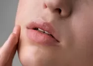 Madu dan 3 Bahan Alami Lainnya untuk Atasi Pigmentasi Bibir, Begini Tips Perawatan Rumahan yang Hemat Budget
