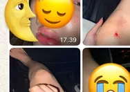 Anggota DPRD Terlibat Dugaan Penganiayaan Mantan Pacar dan Terseret Pinjol! 