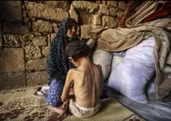 Krisis Kemanusiaan di Gaza Terus Memburuk, Total Warga Meninggal Akibat Kelaparan dan Malnutrisi 251 Orang, Termasuk 110 Anak