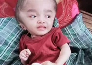 Tangis Maria Bocah 3Tahun di Manggarai Timur: Butuh Pertolongan, Kepala Terus Membesar, Orangtua Habis Harta Demi Pengobatan