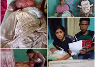 "Mama Peluk Terus Biar Adik Tidak Sakit" - Prisilia, Bayi 2 Minggu Berjuang Lawan Benjolan di Kepala, Orang Tua Pasrah Menanti Uluran Kasih