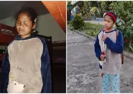"Tolong Selamatkan Jein" - Bocah 11 Tahun di Kaju Wangi Kesakitan Tiap Malam, Orang Tua Pasrah Karena Biaya