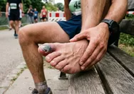 Bagi yang Baru Saja Ikutan Jakim dan JogMar, Cek Kuku Kaki Kamu. Kena Runner's Toe Tidak?