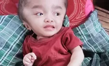 Tangis Maria Bocah 3Tahun di Manggarai Timur: Butuh Pertolongan, Kepala Terus Membesar, Orangtua Habis Harta Demi Pengobatan
