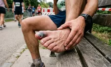 Bagi yang Baru Saja Ikutan Jakim dan JogMar, Cek Kuku Kaki Kamu. Kena Runner's Toe Tidak?