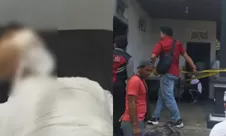 Nasib pilu sopir truk Bali yang dibakar bosnya hingga kritis, rekan korban kini galang donasi