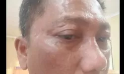 DPD PJS Sumut Desak Polisi Tangkap Pelaku Penganiayaan Wartawan di Lokasi Galian C Ilegal Toba
