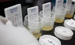 3 Anggota Ditnarkoba Polda Metro, Positif pakai Narkoba.