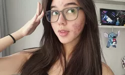 Gabriella Ekaputri Tampil Percaya Diri Meski Wajah Sedang Berjerawat