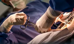 Begini Kondisi Ibu Hamil yang Harus Melahirkan Caesar dan Mengurangi Resiko Kematian Bayi