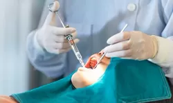 Pasien Operasi Gigi Bungsu di RSHS Bandung Meninggal Dunia