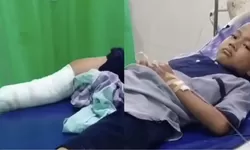Bocah di Jatilawang Alami Kecelakaan Hingga Membuatnya Kehilangan Kaki, Ayah, Ibu dan Kakaknya.